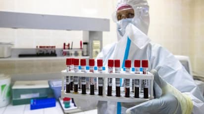 കോഴിക്കോട് ജില്ലയില് 78 പേര്ക്ക് കൂടി കൊവിഡ്; 50 കേസുകളും സമ്പർക്കം വഴി, ഉറവിടം വ്യക്തമല്ലാത്ത എട്ടുപേർ