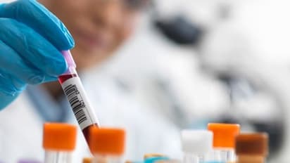 4 people labelled COVID-19 positive without test; West Bengal health department sees panic among residents