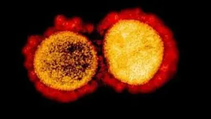 D614G: New coronavirus strain found in Malaysia ‘10 times deadlier’