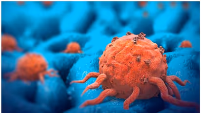 ഇന്ത്യയിൽ അടുത്ത അഞ്ച് വര്‍ഷത്തിനുള്ളില്‍ കാന്‍സര്‍ രോഗികളുടെ എണ്ണം 12 ശതമാനം വര്‍ദ്ധിക്കുമെന്ന് ഐസിഎംആര്‍