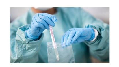 12 പോലീസ് ഉദ്യോഗസ്ഥർക്കും ആലപ്പുഴ നഗരസഭയിലെ മൂന്നുപേര്ക്കും കൊവിഡ്