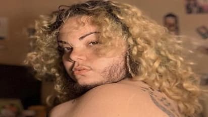 ಸ್ತ್ರೀಯ ದೇಹ, ಪುರುಷನ ಮುಖ ಹೊಂದಿರುವ ಮಹಿಳೆ ಈಕೆ..!