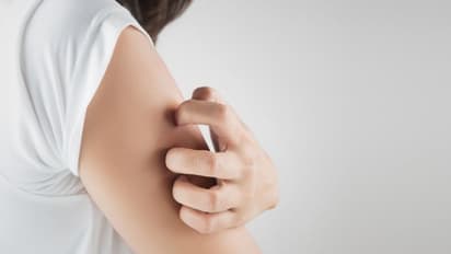 ചര്മ്മത്തില് പാടുകള്, ചുവപ്പ്, ചൊറിച്ചില് എന്നിവയ്ക്ക് കാരണമാകുന്നത്...