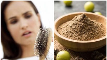 മുടികൊഴിച്ചിൽ കുറയാൻ നെല്ലിക്ക പൊടി ഈ രീതിയിൽ ഉപയോഗിച്ച് നോക്കൂ...