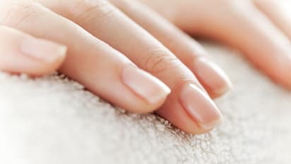 ಉಗುರುಗಳು ದುರ್ಬಲಗೊಳ್ಳಲು ಇವೆ ಕಾರಣ... ಎಚ್ಚರ ಇರಲಿ ಸದಾ