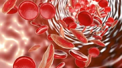 വിളർച്ചയുണ്ടോ? അറിയാം ഈ ലക്ഷണങ്ങള്...