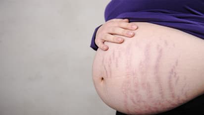 ಮಗು ಯಾವುದೆಂದು ತಿಳಿಯಲು ಪತ್ನಿಯ ಹೊಟ್ಟೆಯನ್ನೇ ಸೀಳಿದ!