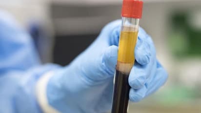 കൊവിഡിനെതിരെ പ്ലാസ്മ തെറാപ്പി; ആശങ്ക പ്രകടിപ്പിച്ച് ലോകാരോഗ്യ സംഘടന