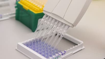 പരിശോധന വർദ്ധിച്ചതോടെ കൊവിഡ് പോസിറ്റീവ് രോഗികളുടെ നിരക്ക് കുറഞ്ഞുവരുന്നതായി ആരോഗ്യമന്ത്രാലയം