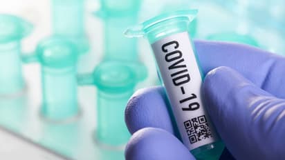 রাজ্য়ে দেড় লক্ষ ছাড়াল করোনা আক্রান্তের সংখ্যা, ২৪ ঘণ্টায় মৃত্যু হয়েছে ৫৩ জনের