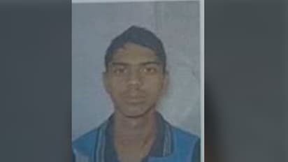 মাথার চুল পড়ে যাওয়ায় লোকের 'ন্যাড়া' টিটকিরি, অপমানে আত্মঘাতী কলেজ ছাত্র