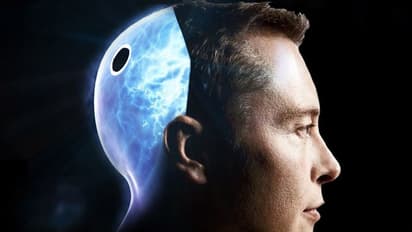 ಎಲಾನ್‌ ಮಸ್ಕ್‌ ಹೊಸ ಸಾಹಸ, ಮಾನವನ ಮೆದುಳಿಗೆ ಚಿಪ್‌!