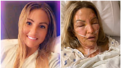 ഹാൻഡ് സാനിറ്റൈസർ ഉപയോഗിച്ച ശേഷം മെഴുകുതിരി കത്തിച്ചു, പിന്നീട് യുവതിയ്ക്ക് സംഭവിച്ചത്....