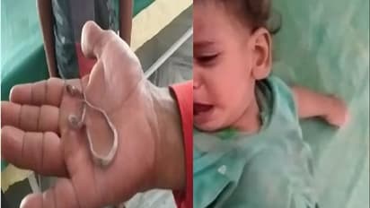 खेल-खेल में जिंदा सांप को निगल गया बच्चा, मुंह में पूंछ देखकर हैरान रह गया परिवार, फिर...