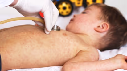 കൊവിഡ് 19ന് ശേഷം കുട്ടികളില്‍ പിടിപെടുന്ന അസുഖം; ഹൃദയത്തെ സാരമായി ബാധിക്കുന്നതായി വിദഗ്ധര്‍