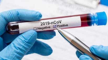 காய்ச்சல் இருந்தால் உடனடியாக கொரோனா பரிசோதனை செய்வது அவசியம்.. இல்லையென்றால் நிலைமை மோசமாகும்..!