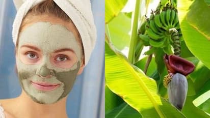 কলার খোসা থেকে পাতা, ক্ষত স্থান নিরাময়ে কাজে লাগান ঘরোয়া টোটকা