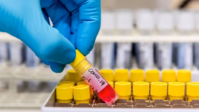 Coronavirus: Bengaluru overtakes Mumbai in COVID-19 cases tally; 2nd worst-hit city now