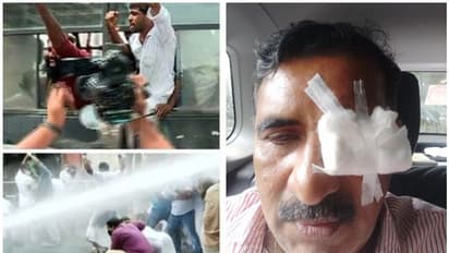 കെ ടി ജലീലിന്റെ രാജി ആവശ്യപ്പെട്ട് നടന്ന പ്രതിഷേധത്തിനിടെ സംഘര്ഷം, ബി ഗോപാലകൃഷ്ണന് പരിക്ക്