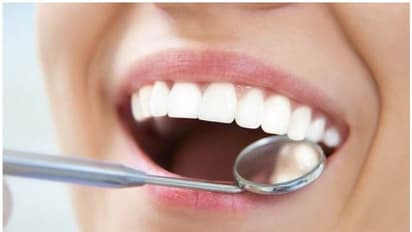 മോണയുടെയും പല്ലിന്റെയും ആരോ​ഗ്യത്തിന് ശ്രദ്ധിക്കേണ്ട 5 കാര്യങ്ങൾ ഇതാണ്