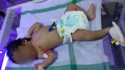 ಪ್ಲಾಸ್ಟಿಕ್ ಕವರ್‌ನಲ್ಲಿ ನವಜಾತ ಗಂಡು ಮಗು ಪತ್ತೆ: ರಕ್ಷಣೆ ಮಾಡಿದ ಶಿವಮೊಗ್ಗ ಆರೋಗ್ಯ ಇಲಾಖೆ