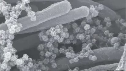 ஆண்களின் ஆண்மைக்கு ஆபத்து..! அடுத்தடுத்து அட்டாக் பண்ணும் வைரஸ் நோய்.!