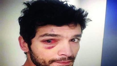 Sandalwood drug case: Diganth accepts consumption of drugs; here’s why he used drugs