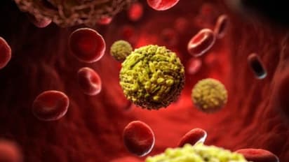 Coronavirus: Spike of 86,052 cases takes India’s COVID-19 tally past 58-lakh mark