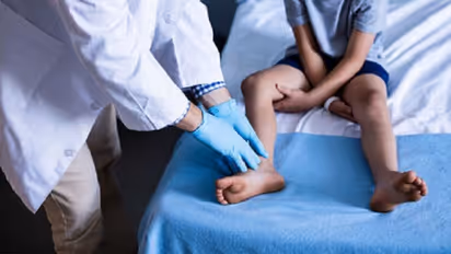 DART successfully develops India’s first medicine to treat Duchenne Muscular Dystrophy