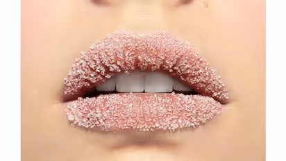 ചുണ്ട് വരണ്ട് പൊട്ടുന്നുണ്ടോ? എളുപ്പം പരിഹരിക്കാം...