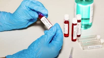 కరోనా ఎఫెక్ట్: చిత్తూరు, కడప, శ్రీకాకుళం జిల్లాల్లో మినీ లాక్‌డౌన్