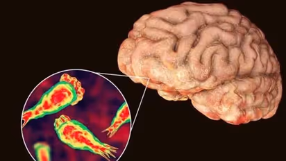 Brain Eating Amoeba : തലച്ചോര് ഭക്ഷിക്കുന്ന അമീബ ; ഒരു മരണം, എന്താണ് നെഗ്ലേരിയ ഫൗലേരി?