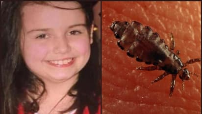 നിരന്തരം പേന് കടിയേറ്റ് പന്ത്രണ്ടുകാരി മരണപ്പെട്ടു; അച്ഛനും അമ്മയും പ്രതികള്