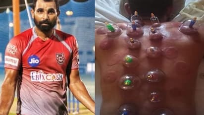 ম্য়াচের আগে শরীর থেকে দূষিত রক্ত বার, শামির শেয়ার করা ছবিতে  শিউড়ে উঠল নেট দুনিয়া