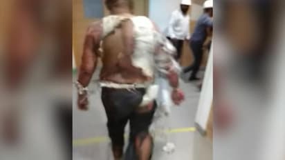 Bengaluru: Two critically injured after fire accident in KPTCL plant