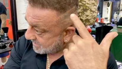 ಚಿಕಿತ್ಸೆಯ ಗುರುತು ತೋರಿಸಿದ ಸಂಜಯ್ ದತ್: ಕ್ಯಾನ್ಸರ್‌ನಿಂದ ಬೇಗ ಹೊರ ಬರ್ತೀನಿ ಎಂದ KGF ನಟ