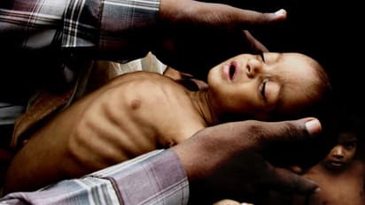 ক্ষুধা নিবৃত্তিতে পাকিস্তানের থেকেও পিছিয়ে ভারত, চিন তো ধরা-ছোঁয়ার বাইরে