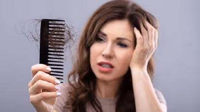 ಅತಿಯಾದ ಹೇರ್ ಫಾಲ್‌ನಿಂದ ಕಿರಿಕಿರಿ: ಚಿಂತೆ ಬಿಟ್ಟು ಹೀಗ್ಮಾಡಿ