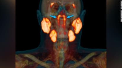 മനുഷ്യ ശരീരത്തില്‍ പുതിയ ഒരു അവയവം കൂടി കണ്ടെത്തി
