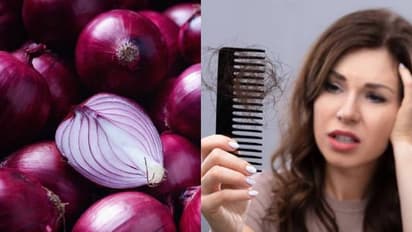 വില പോലെ തന്നെ ഗുണവും; തലമുടി കൊഴിച്ചിൽ അകറ്റാന്‍ ഉള്ളി കൊണ്ടുള്ള പൊടിക്കൈകള്‍...