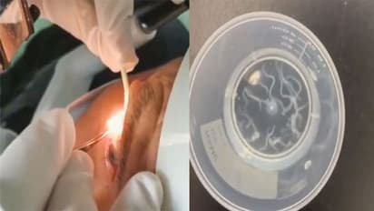 शख्स को लगा- बुढ़ापे के कारण कमजोर हो गई थी आंखें, चेक करते ही डॉक्टर्स की निकल पड़ी चीख