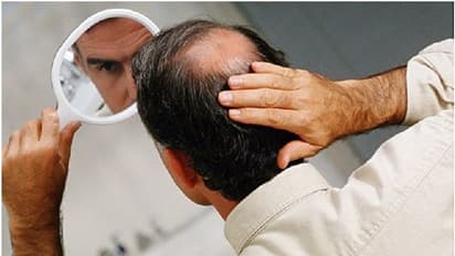 ಬೊಕ್ಕ ತಲೆಗೆ ಉಚಿತ ಚಿಕಿತ್ಸೆ ಪಡೆದವರಿಗೆ ಶಾಕ್, ದೃಷ್ಠಿ ಕಳೆದುಕೊಂಡು 60 ಮಂದಿ ಆಸ್ಪತ್ರೆ ದಾಖಲು