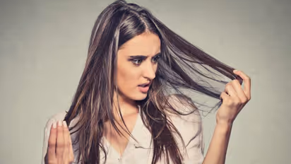 இளநரை இருக்கா? கவலையை விடுங்க.. இந்த 7 உணவுகளை மட்டும் உணவில் சேர்த்துக்கோங்க..!!