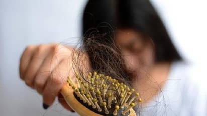 താരൻ അകറ്റാനും തലമുടി കൊഴിച്ചിൽ തടയാനും കിടിലനൊരു എണ്ണ!