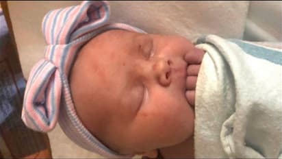 ಎಡಗಾಲಿನಲ್ಲಿ ಮಾತ್ರ ಒಂಭತ್ತು ಬೆರಳುಳ್ಳ ಮಗು ಜನನ