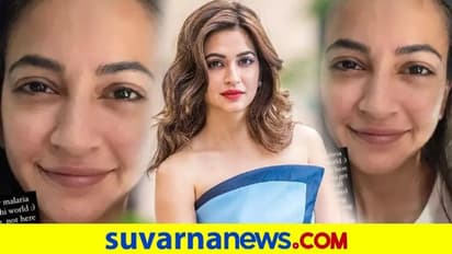 ಮಲೇರಿಯಾದಿಂದ ಮುಖ ಹೇಗಾಗಿದೆ ನೋಡಿ; ನಟಿ ಕೃತಿ ಫೋಟೋ ವೈರಲ್!