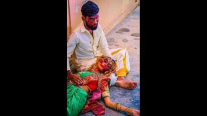 ಇದೆಂಥಾ ಹುಚ್ಚುತನ..? ನವ ಜೋಡಿ ರಕ್ತಸಿಕ್ತ..! ಫೊಟೋಸ್ ನೋಡಿ