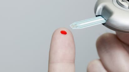 Diabetes Tips: ডায়াবেটিস ক্রমে উদ্বেগ বাড়াচ্ছে চিকিৎসকদের, জেনে নিন কীভাবে সতর্ক হবেন এই রোগ থেকে