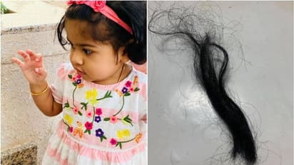 ഉറക്കത്തിനിടെ അമ്മയുടെ മുടി കഴുത്തില് കുരുങ്ങി, ശ്വാസംമുട്ടിയ കുഞ്ഞിനെ രക്ഷിച്ച സംഭവം വിവരിച്ച് പിതാവ്