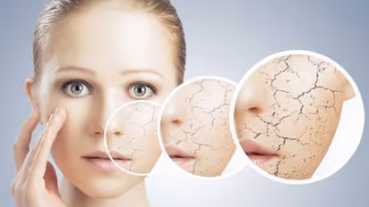 Healthy eating to drinking water: Here's how to take care of your skin in winter days